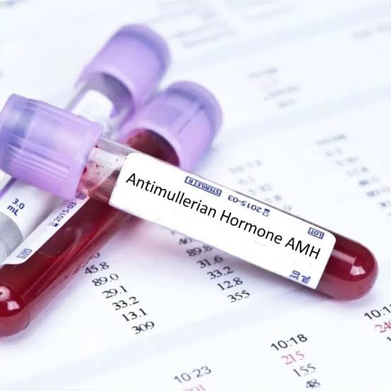 AMH Test in Noida Process