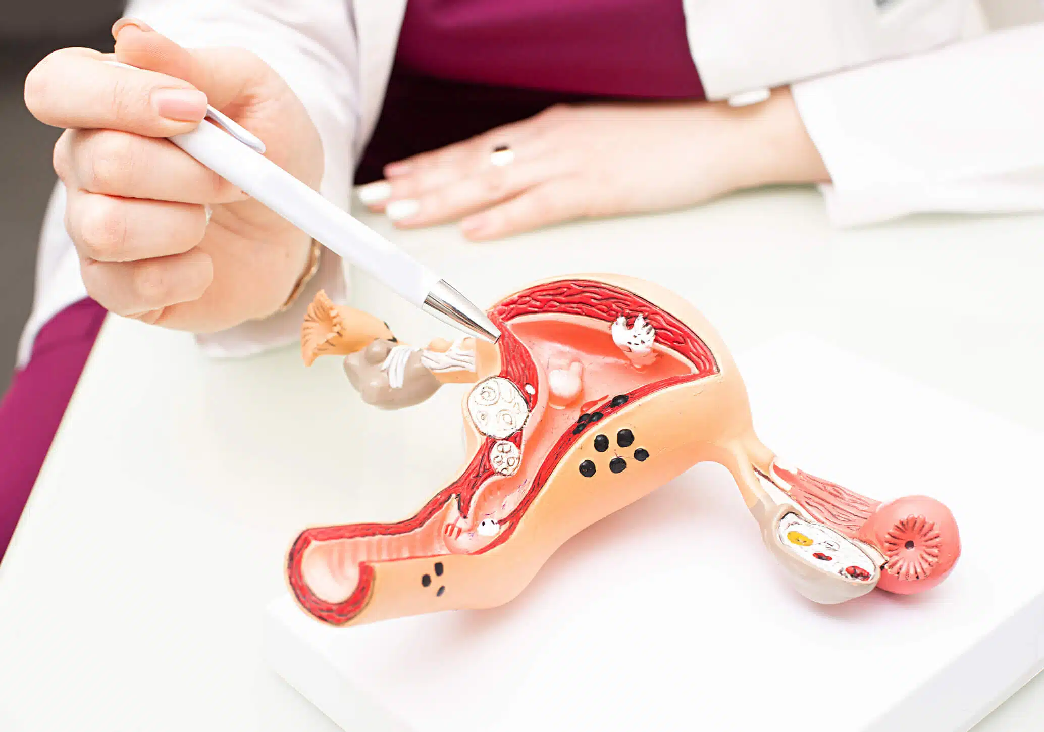 HSG Tube Test in Noida at Anaya IVF & Fertility Care
