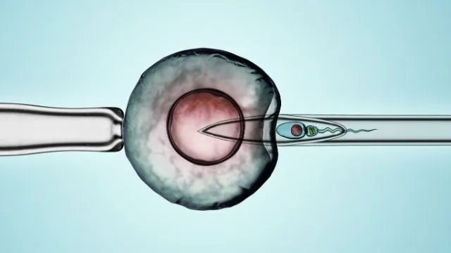 IMSI IVF Treatment in Noida - Anaya IVF & Fertility Care