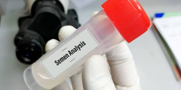 Semen Analysis and Culture Treatment in Noida - Anaya IVF & Fertility Care
