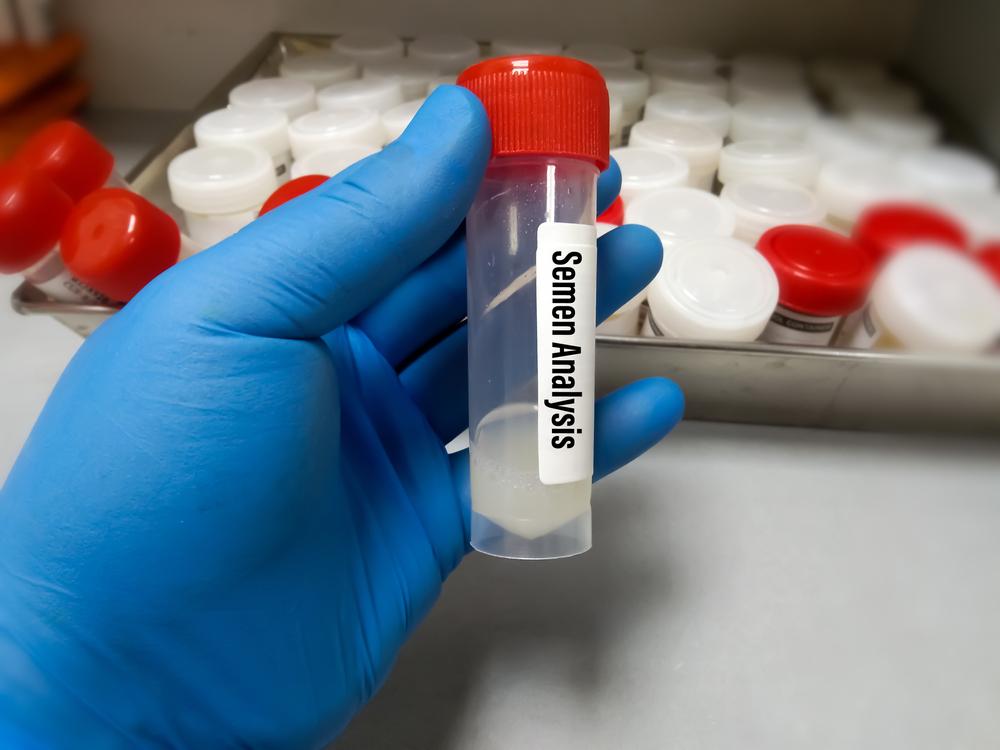 Semen Analysis and Culture Treatment in Noida Process