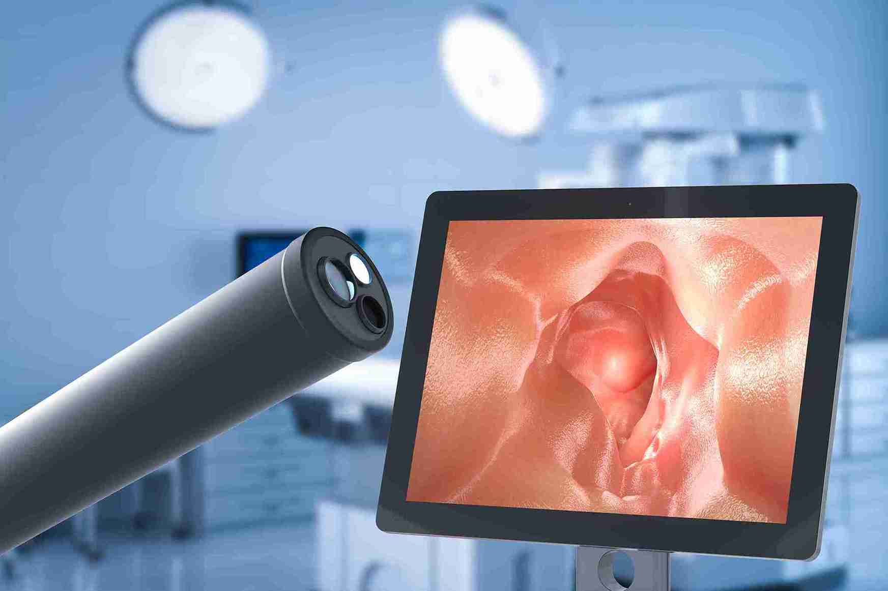 Ultrasound & Ovulation Study in Noida at Anaya IVF & Fertility Care
