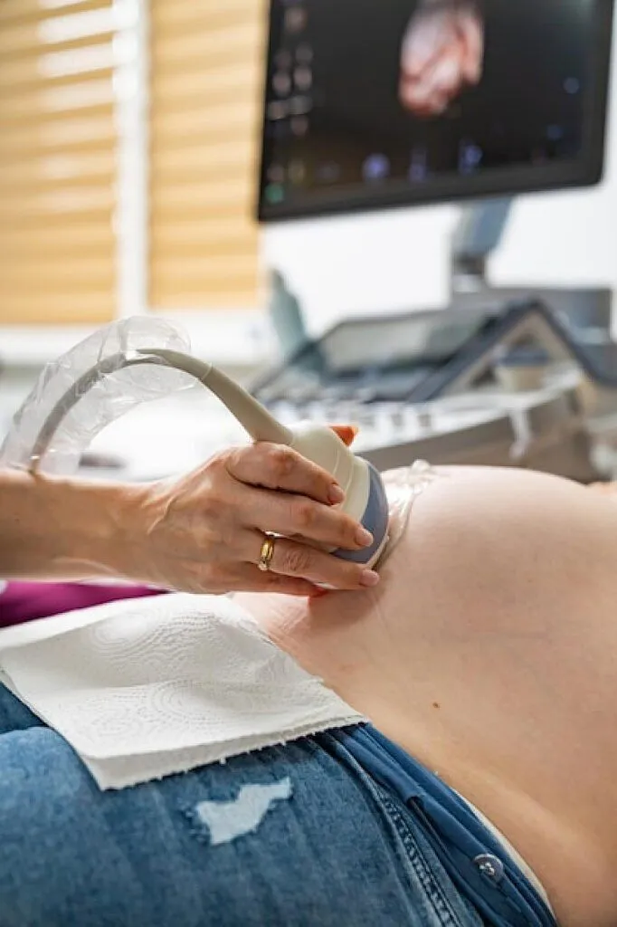 Ultrasound & Ovulation Study in Noida Process